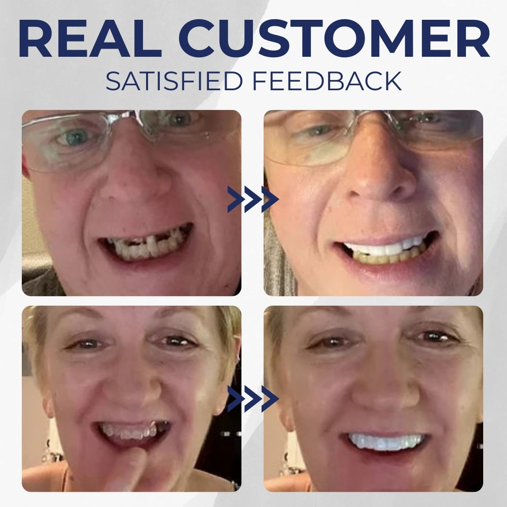 Hidone™ - Denture Set